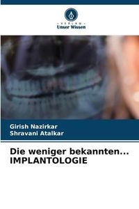 Produktbild: Die weniger bekannten... IMPLANTOLOGIE