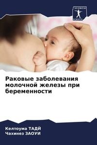 Produktbild: Rakowye zabolewaniq molochnoj zhelezy pri beremennosti