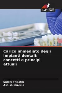 Produktbild: Carico immediato degli impianti dentali: concetti e principi attuali