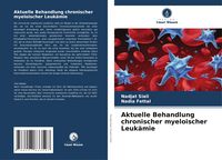 Produktbild: Aktuelle Behandlung chronischer myeloischer Leuk&auml;mie