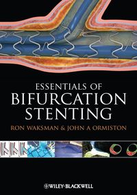 Produktbild: Bifurcation Stenting
