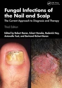 Produktbild: Fungal Infections of the Nail and Scalp