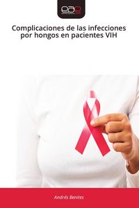 Produktbild: Complicaciones de las infecciones por hongos en pacientes VIH