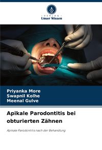 Produktbild: Apikale Parodontitis bei obturierten Z&auml;hnen