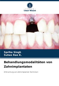 Produktbild: Behandlungsmodalit&auml;ten von Zahnimplantaten