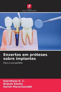 Produktbild: Enxertos em pr&oacute;teses sobre implantes