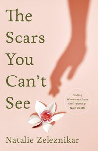 Bild vom Artikel The Scars You Can't See: Finding Wholeness from the Trauma of Near Death vom Autor Natalie Zeleznikar