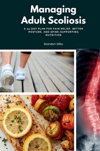 Produktbild: Managing Adult Scoliosis