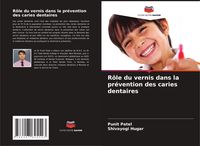 Produktbild: R&ocirc;le du vernis dans la pr&eacute;vention des caries dentaires