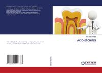 Produktbild: ACID ETCHING