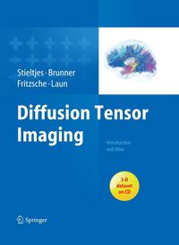 Produktbild: Diffusion Tensor Imaging