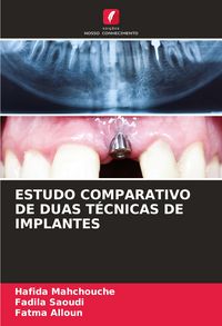 Produktbild: Estudo Comparativo De Duas T&eacute;cnicas De Implantes