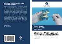 Produktbild: Okklusale &Uuml;berlegungen in der Implantatprothetik