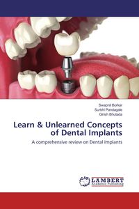 Produktbild: Learn & Unlearned Concepts of Dental Implants