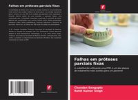 Produktbild: Falhas em pr&oacute;teses parciais fixas