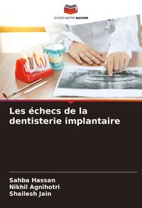 Produktbild: Les &eacute;checs de la dentisterie implantaire