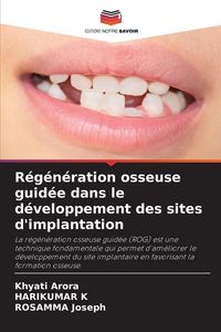 Produktbild: R&eacute;g&eacute;n&eacute;ration osseuse guid&eacute;e dans le d&eacute;veloppement des sites d'implantation