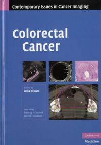 Produktbild: Colorectal Cancer
