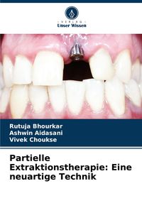 Produktbild: Partielle Extraktionstherapie: Eine neuartige Technik