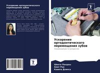 Produktbild: Uskorenie ortodonticheskogo peremescheniq zubow