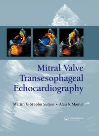 Produktbild: Mitral Valve Transesophageal Echocardiography