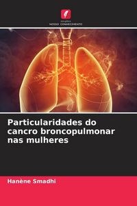 Produktbild: Particularidades do cancro broncopulmonar nas mulheres