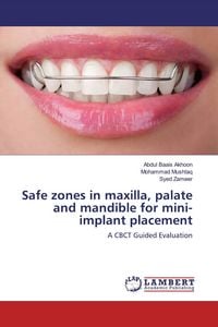 Produktbild: Safe zones in maxilla, palate and mandible for mini-implant placement