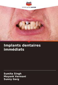 Produktbild: Implants dentaires imm&eacute;diats