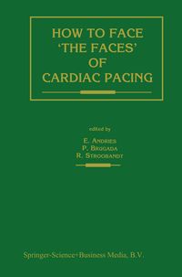 Produktbild: How to face &lsquo;the faces&rsquo; of CARDIAC PACING