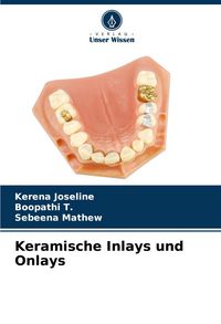 Produktbild: Keramische Inlays und Onlays