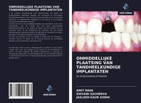 Produktbild: Onmiddellijke Plaatsing Van Tandheelkundige Implantaten