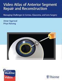 Produktbild: Video Atlas of Anterior Segment Repair and Reconstruction