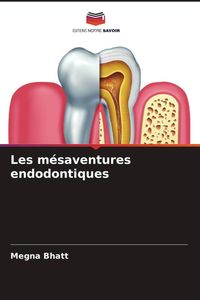 Produktbild: Les m&eacute;saventures endodontiques
