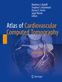 Produktbild: Atlas of Cardiovascular Computed Tomography