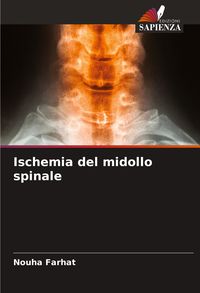 Produktbild: Ischemia del midollo spinale
