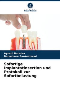 Produktbild: Sofortige Implantatinsertion und Protokoll zur Sofortbelastung