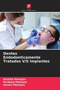 Produktbild: Dentes Endodonticamente Tratados V/S Implantes