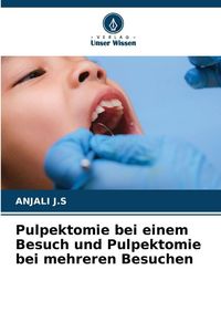 Produktbild: Pulpektomie bei einem Besuch und Pulpektomie bei mehreren Besuchen