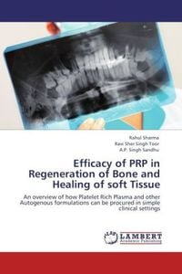 Produktbild: Sharma, R: Efficacy of PRP in Regeneration of Bone and Heali