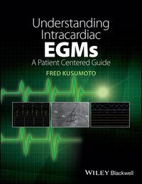 Produktbild: Understanding Intracardiac EGMs