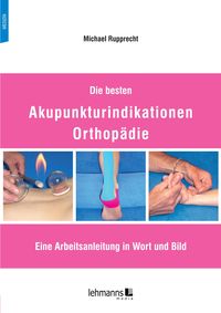 Produktbild: Die besten Akupunkturindikationen Orthop&auml;die