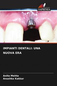 Produktbild: Impianti Dentali: Una Nuova Era