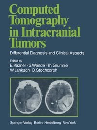 Produktbild: Computed Tomography in Intracranial Tumors