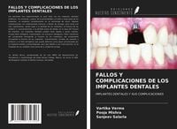 Produktbild: Fallos Y Complicaciones De Los Implantes Dentales
