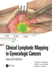 Produktbild: Clinical Lymphatic Mapping in Gynecologic Cancers