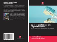 Produktbild: Op&ccedil;&otilde;es prot&eacute;ticas em Implantodontia