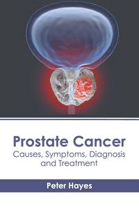 Produktbild: Prostate Cancer: Causes, Symptoms, Diagnosis and Treatment