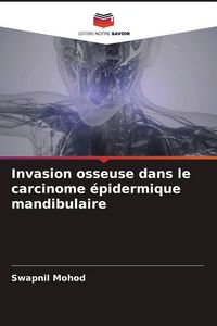 Produktbild: Invasion osseuse dans le carcinome &eacute;pidermique mandibulaire