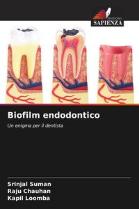 Produktbild: Biofilm endodontico