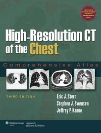 Produktbild: High-Resolution Ct Of The Ches